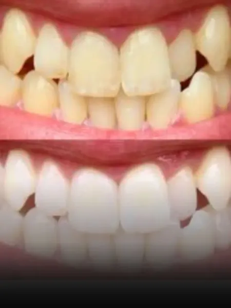teeth