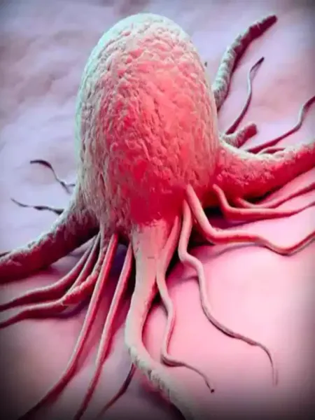 Cancer-ke-Ayurvedic-upay