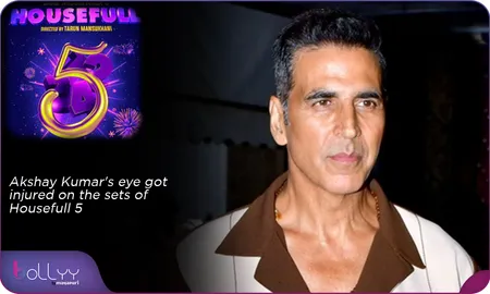 Akshay Kumar's eye got injured on the sets of Housefull 5
