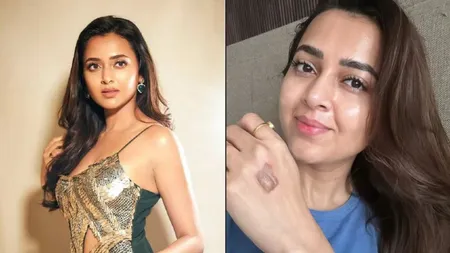 Tejasswi Prakash Says ‘The Show Must Go On’ After Injury on Set
