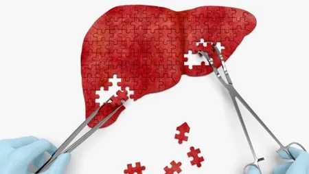 Ways to reduce liver infection 