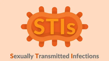 STI 