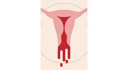 Heavy Period (Yahoo)