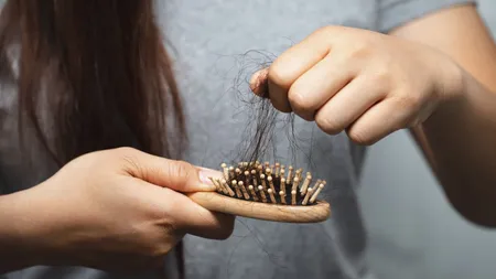 Hair Loss 