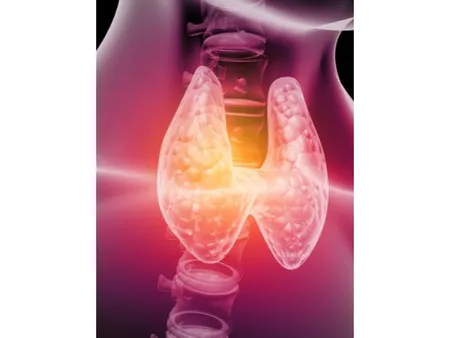 Foods To Avoid In Thyroid 