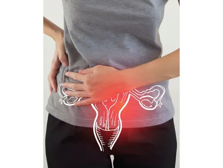 PCOS Weight Loss(Max HealthCare)