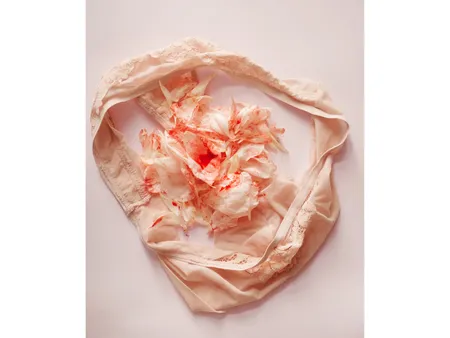 leg pain during periods