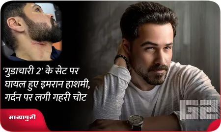 'Goodachari 2' के सेट पर घायल हुए इमरान हाशमी, गर्दन पर लगी गहरी चोट