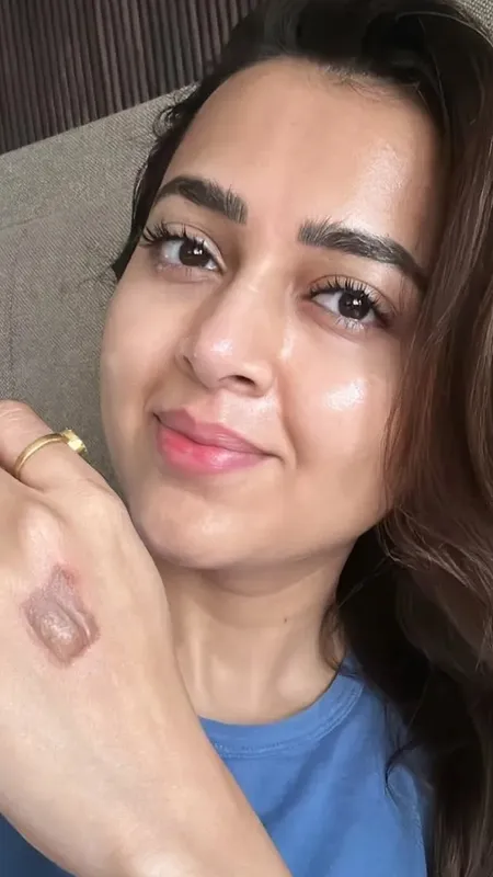 सेलिब्रिटी मास्टरशेफ की शूटिंग के दौरान चोट लगने पर बोली तेजस्वी