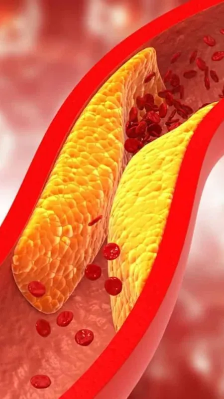 कोलेस्ट्रॉल कम करने का सबसे आसान तरीका!