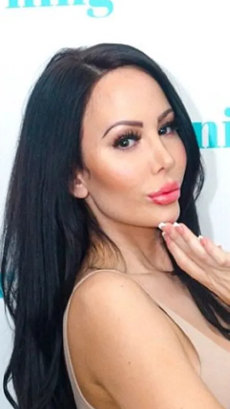 खूबसूरत दिखने के लिए करवाई 200 सर्जरी, खर्च कर डाले इतने करोड़