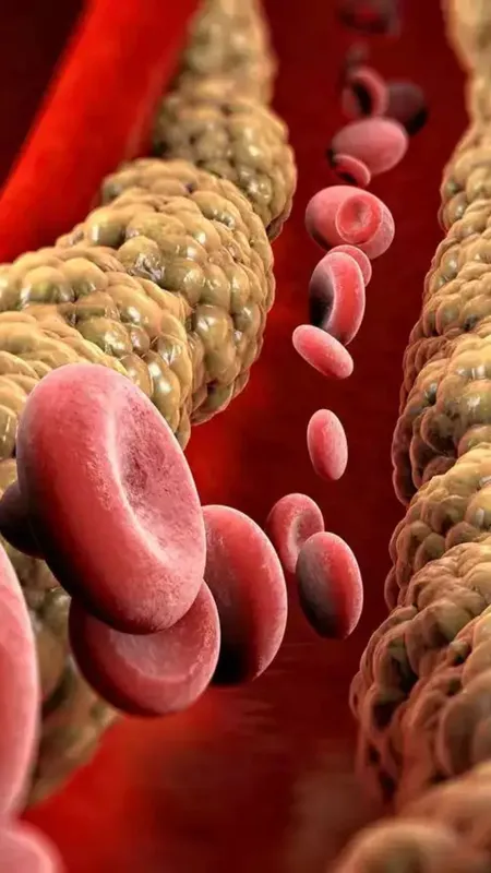 इन चीजों के सेवन से बढ़ता है कोलेस्ट्रॉल!