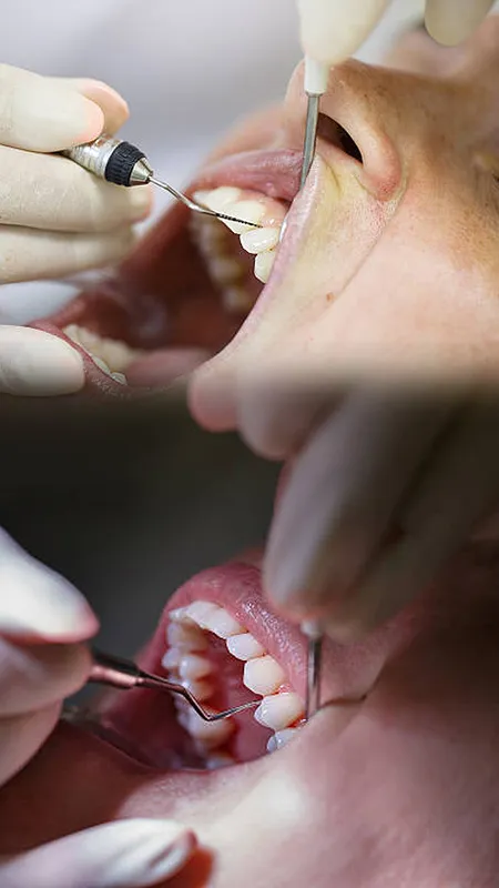 Pyorrhea की प्रॉब्लम होगी दूर, इन पत्तों को चबाने से हुजूर