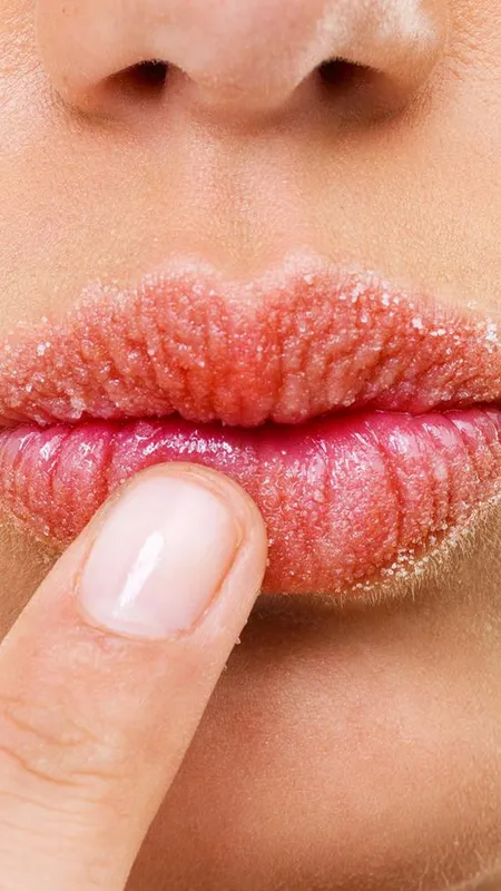 Health: सर्दियों में फटे होठों पर करें खास उपाए!