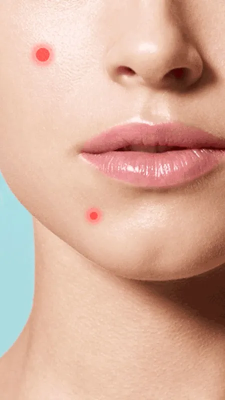 स्किन संबंधी समस्याओं में रामबाण इलाज है ये फूल!