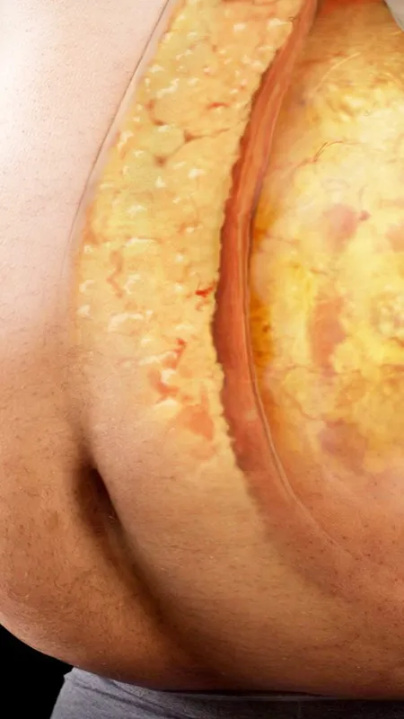 बेली फैट से हैं परेशान तो अपनी इन आदतों पर दें ध्यान