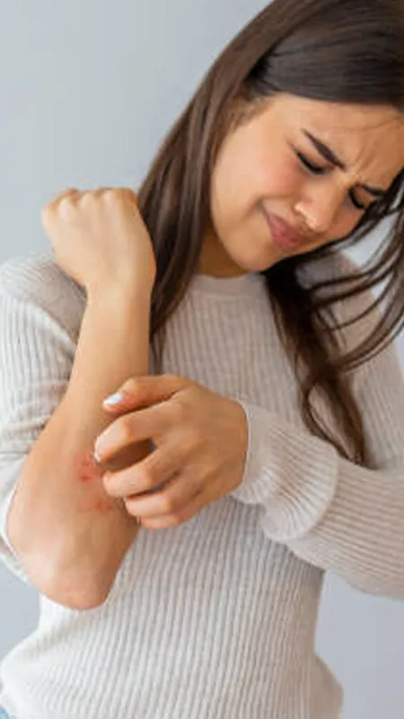 गर्मियों में खुजली से मिलेगा छुटकारा, लें इन घरेलू नुस्खों का सहारा