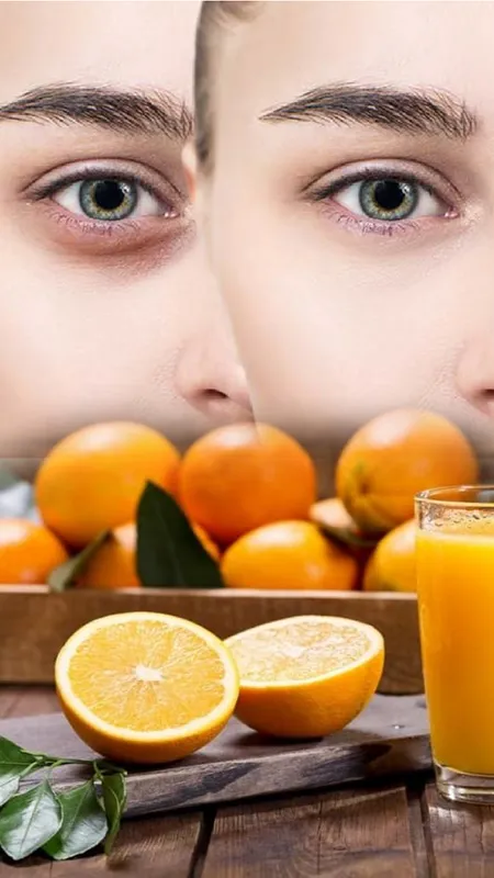 क्या आप भी है काले घेरे परेशान ? क्या करें और क्या न करें !