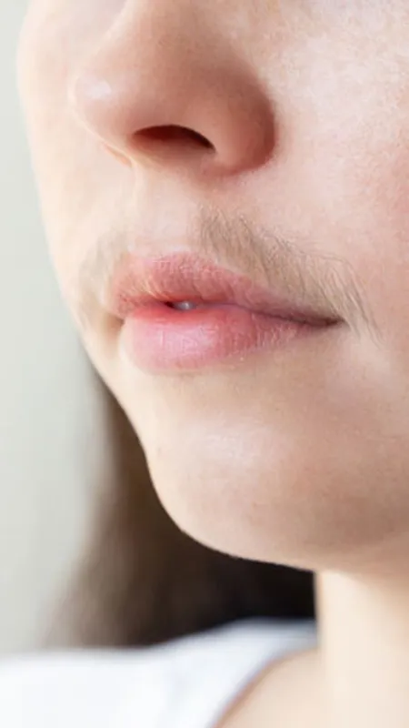 क्या आपके भी अपर लिप्स पर जल्दी आ जाते हैं हेयर, तो फॉलो करें ये टिप्स