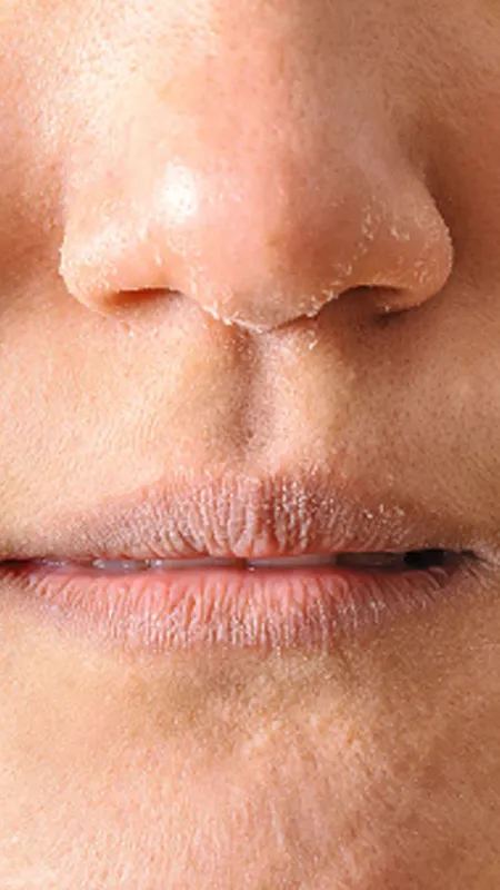 सर्दियों में Dry Skin से चाहिए छुटकारा, इन घरेलू उपायों का लें सहारा