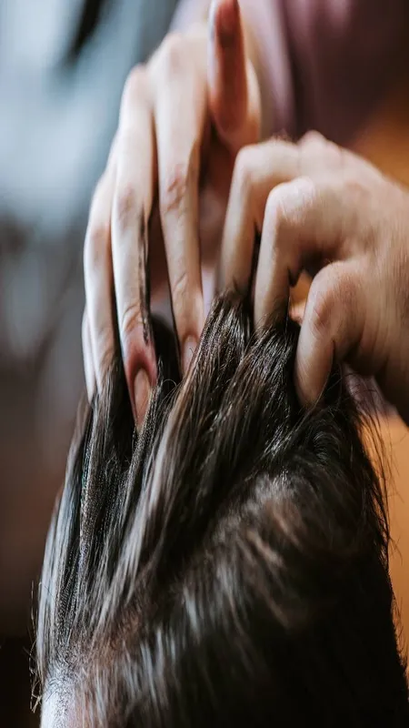 dandruff2