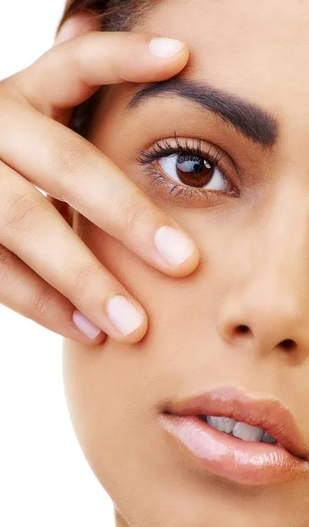 Dark circles under eyes