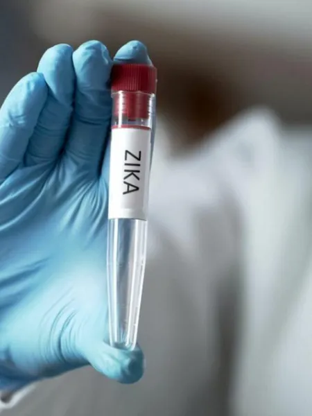 First case of Zika Virus Confirmed in Karnataka. Here's what you need to know