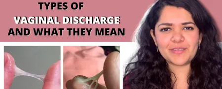 types of vaginal discharge