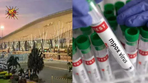 Mpox: 21 Days Quarantine To International Passenger In Bengaluru