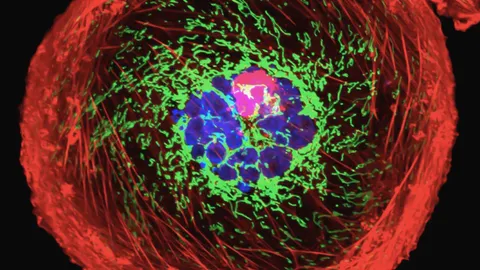 India Sees 9.3 Lakh Cancer Deaths, Second Highest in Asia: LANCET Study