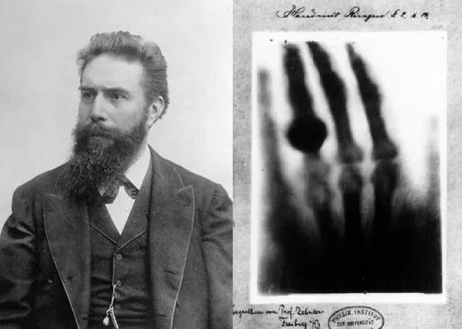 Who discovered X-rays ? | Know-It-All