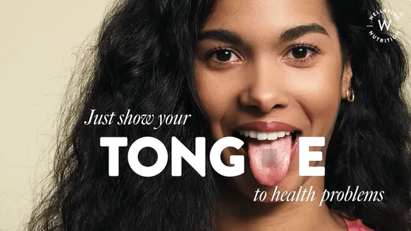 Wellbeing Nutrition urges Indians to #ShowTheirTongue as a sign of victory over health issues