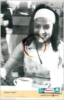 Stained teeth?*