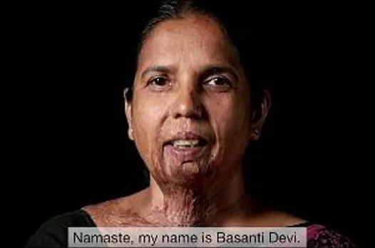 Ogilvy creates video CVs for acid-attack survivors