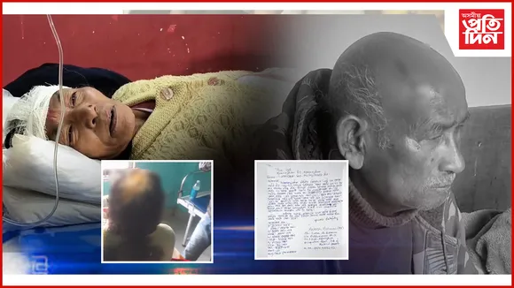 হাতে হাতে দালৈ প্ৰতিবেশীয়ে কৰা আক্ৰমণত আহত পিতৃ, মাতৃ আৰু পুত্ৰ