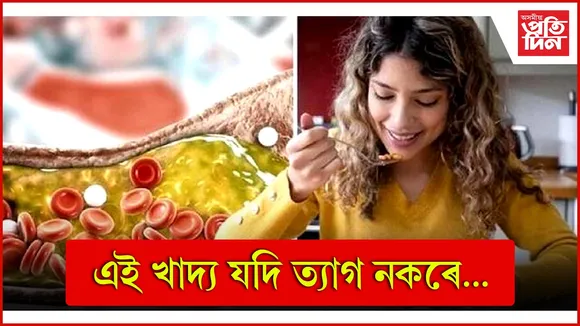 খাদ্য  web