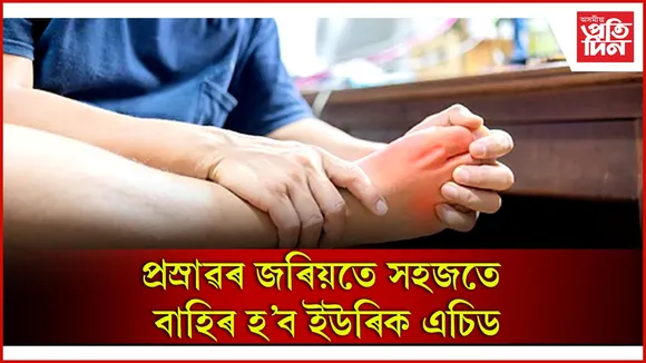 ইউৰিক এচিড