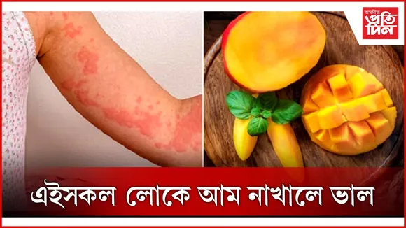 আম 