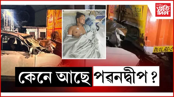 সৰ্ব শৰীৰত হাড় ভাঙিছে পৱনদ্বীপৰঃ ৬ ঘণ্টাৰ অস্ত্ৰোপচাৰ সম্পন্ন, চাৰি দিনৰ পাছত আকৌ হ'ব অস্ত্ৰোপচাৰ