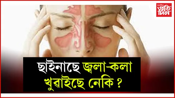 ছাইনাছে  web