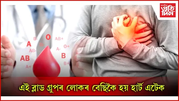 ব্লাড গ্ৰুপ