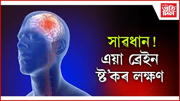ব্ৰেইন ষ্ট'ক seo (1)