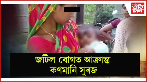 জটিল ৰোগত আক্ৰান্ত কণমানি সুৰজ