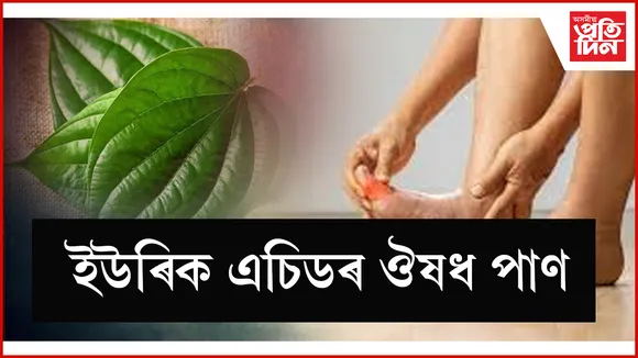 seo  ইউৰিক এচিড