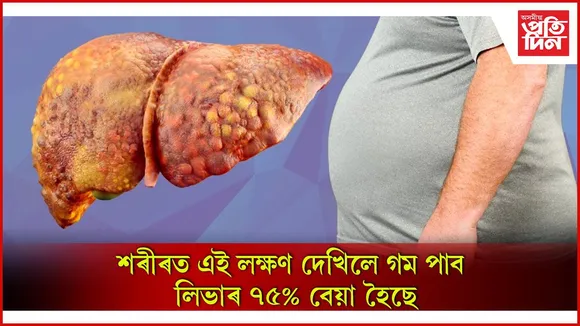লিভাৰ