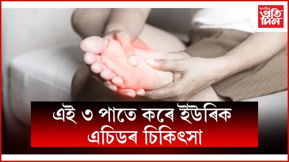 web ap uric acid