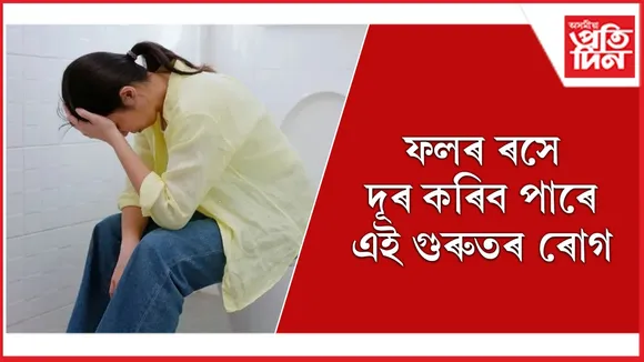 ৰোগ web