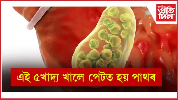 খাদ্য  seo
