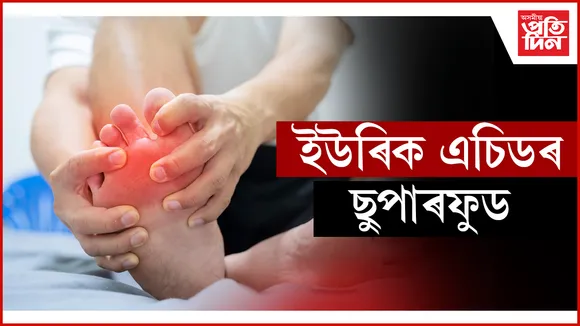 ইউৰিক এচিড seo