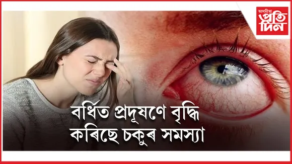 চকুৰ সমস্যা seoo